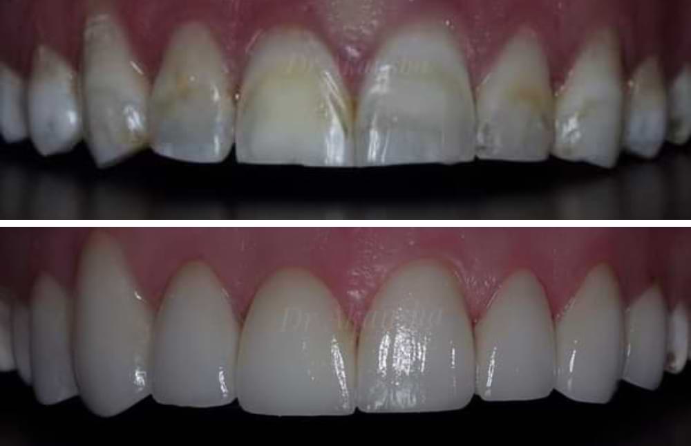 Smile make over case