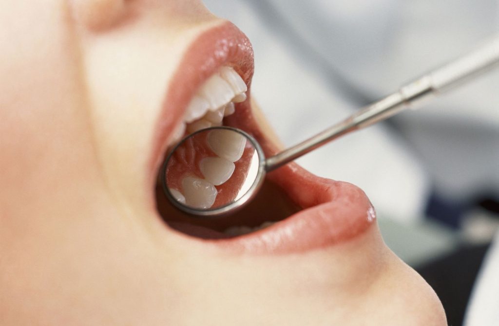 Most Common Dental Problems and Solutions With Images