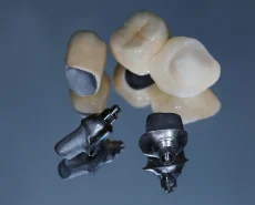 An assortment of different types of dental crowns and bridges used for tooth restoration.