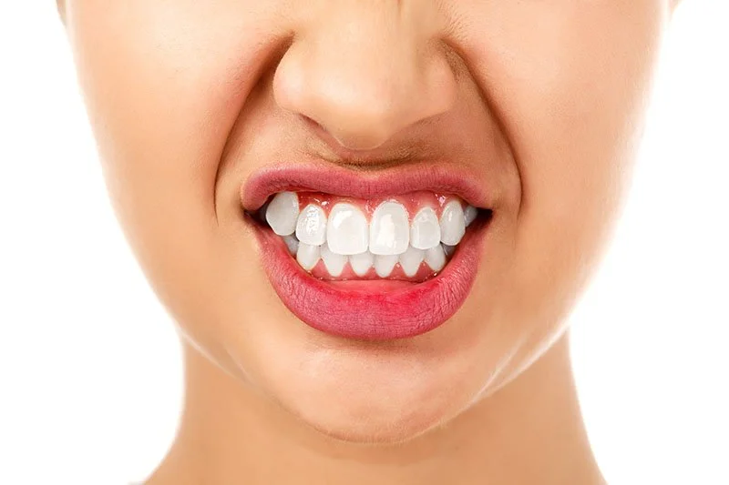 Bruxism