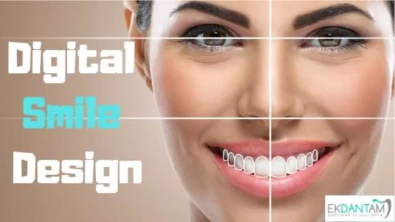 Digital Smile Designing For a Beautiful Smile