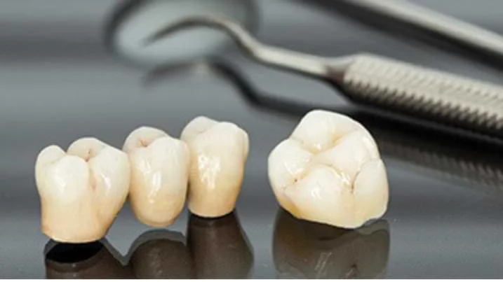 How do Digital Crowns and Bridges offer Patients Quality Restorations
