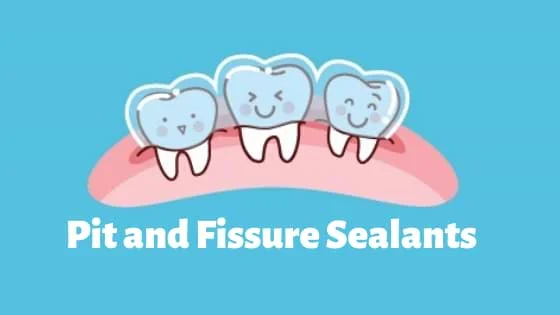Pit and Fissure Sealants